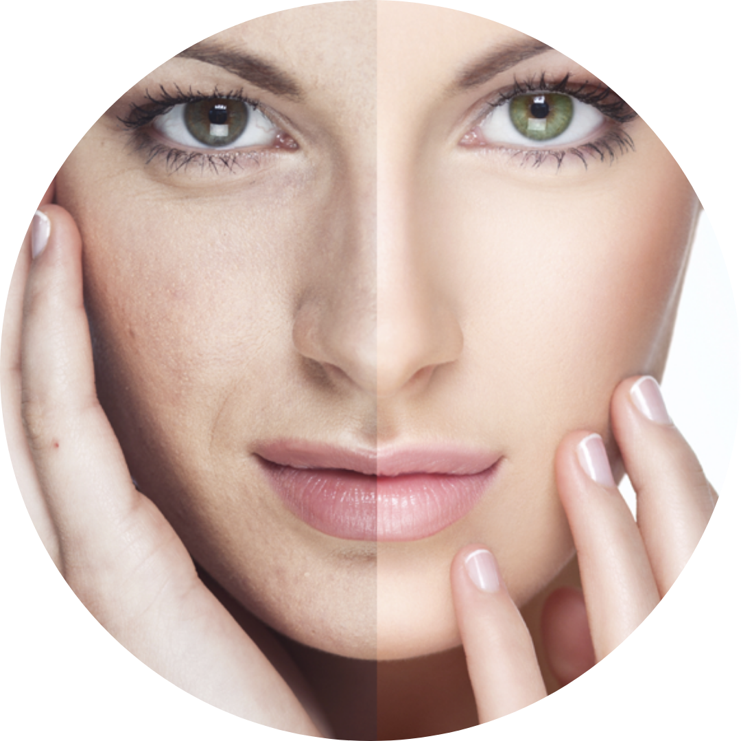 Pelling Facial Dr Sisy Suarez