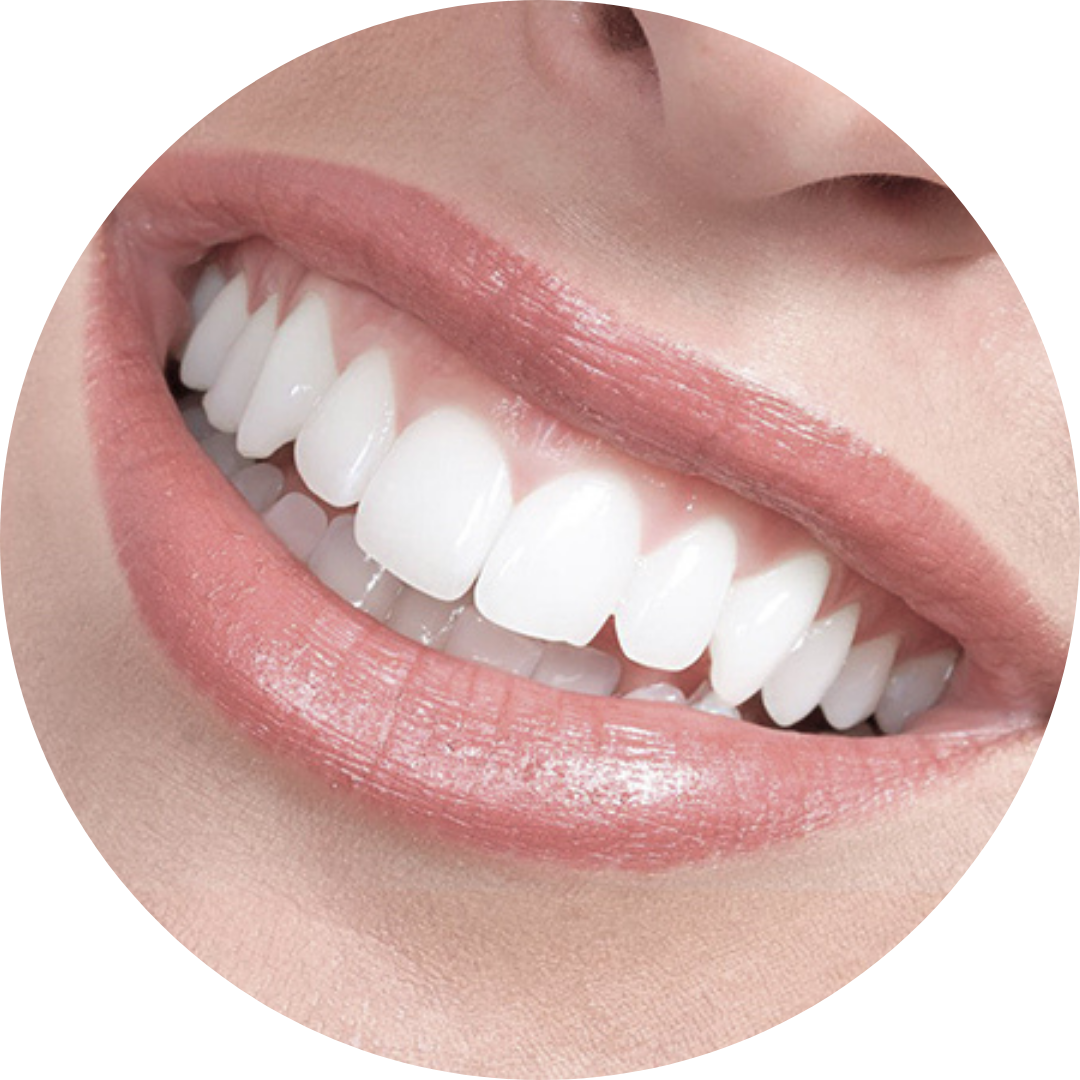 Sorriso Gengival Dra Sisy Suarez